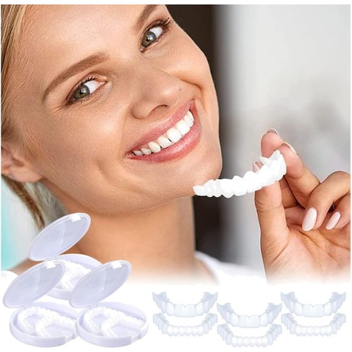 Faccette dentali cosmetiche
