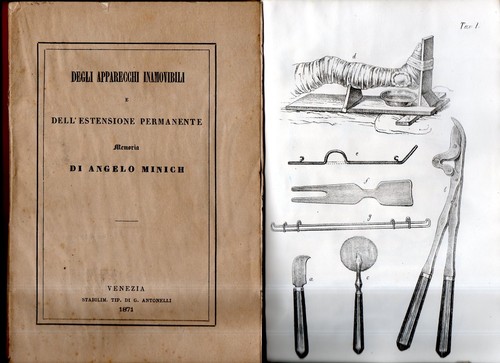 Minich apparecchi inamovibili - minich,