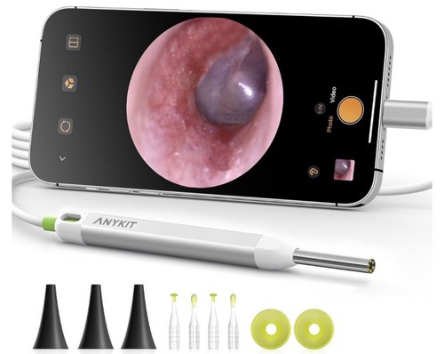 Anykit otoscopio digitale - anykit,