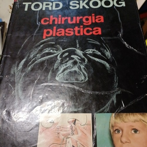 Chirurgia plastica tord skoog - plastica,