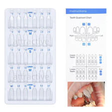 Faccette in resina composita