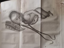 DELL'ARTE OSTETRICIA Vol. 1, 2, 3, 4 (collezione rara completa a soli € 500,00)