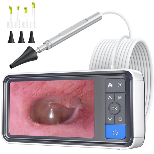 Scopearound otoscopio con - scopearound,