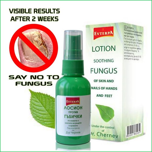 Lozione antifungina 50ml - lozione,