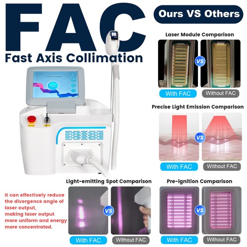 Macchina depilazione laser - , a