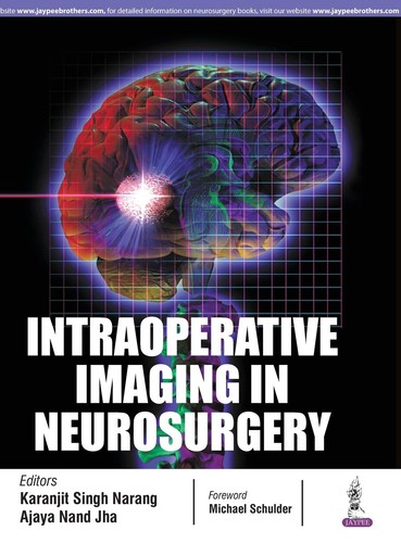 Intraoperative imaging - intraoperative, in