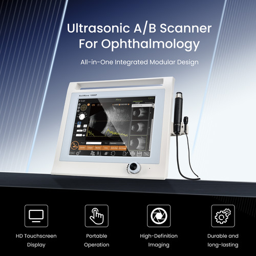 Scanner ultrasuoni - scanner,