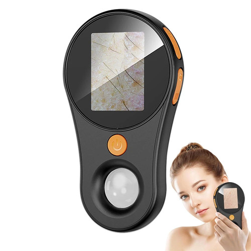 Dermatoscopio portatile - dermatoscopio,