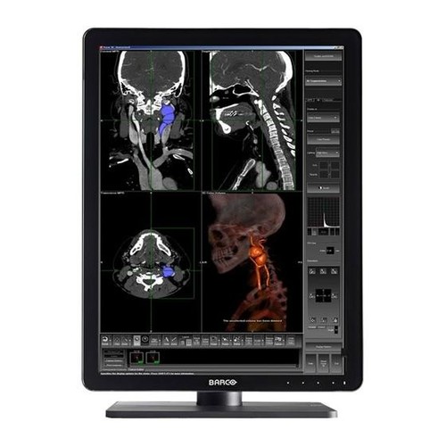 Monitor medicale barco - monitor,