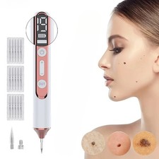 Penna laser al plasma per