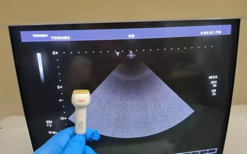 Trasduttore ultrasuoni toshiba - ultrasuoni,