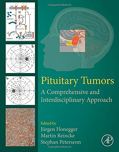 Pituitary tumors a - pituitary, tumors: