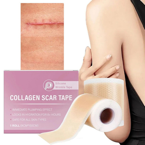 Nastro cicatrice collagene