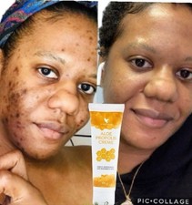 Forever Aloe Vera kit Gelly