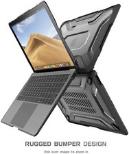 SUPCASE for Apple MacBook Pro