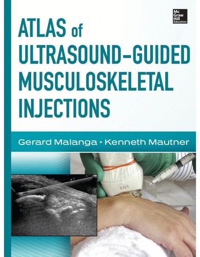 Atlas ultrasound guided - atlas, ultrasound-guided