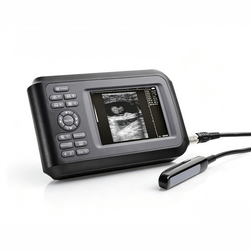 Ultrasuoni diagnostici