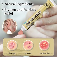 Crema Psoriasi Ingredienti