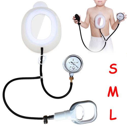 Pectus excavatum campana - pectus,