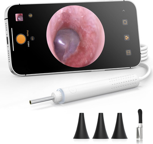 Otoscopio per fotocamera