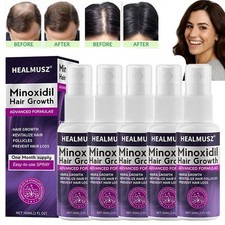 Minoxidil 2% Donna Trattamento