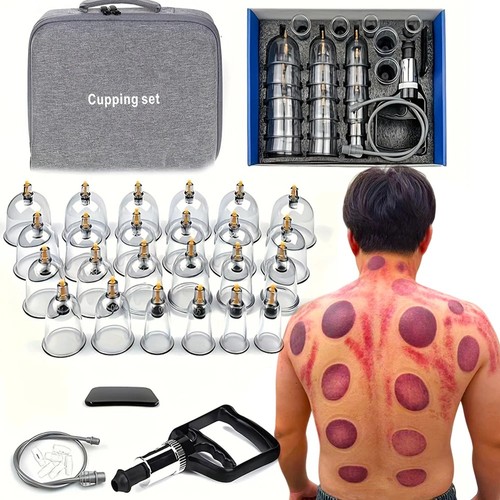 Set coppettazione terapia - coppettazione,