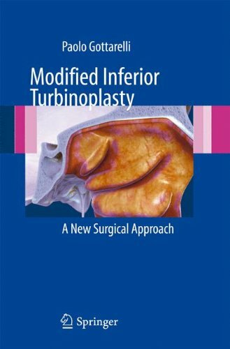Modified inferior - modified,