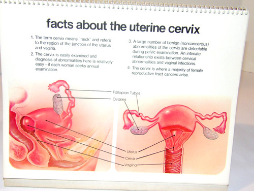 1976 cervix doctor office - cervix,