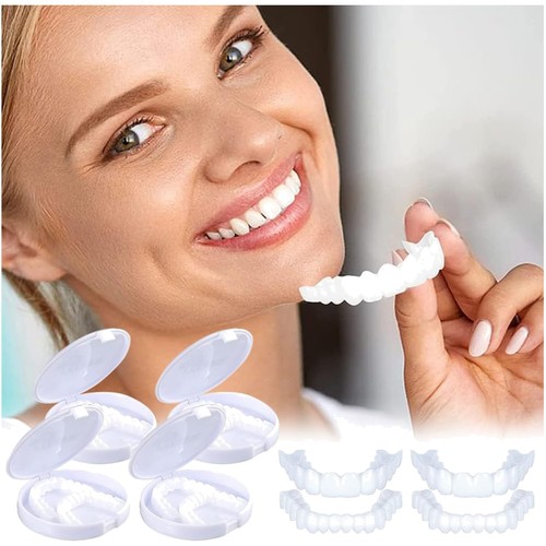 Faccette denti cosmetiche - cosmetiche, 4