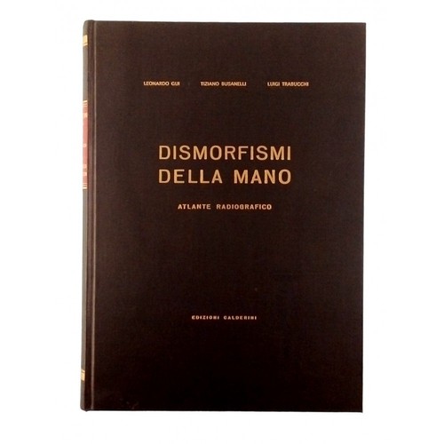 Dismorfismi della mano atlante - dismorfismi,