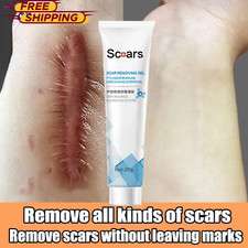2x Crema Rimozione Cicatrici