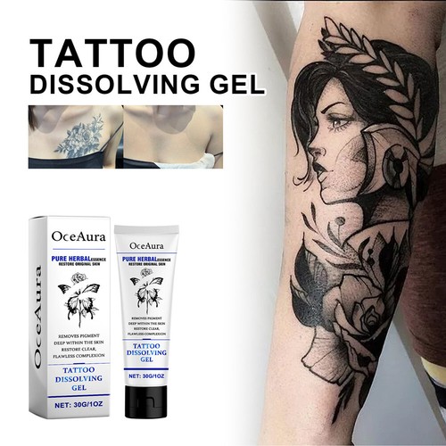 Crema rimozione tatuaggi - rimozione,