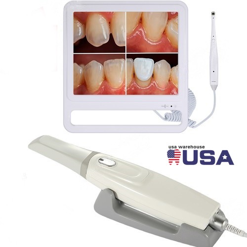 Scanner intraorale dentale