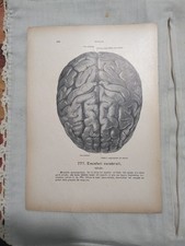 Lotto 2 Stampe Anatomiche Mediche Encefalo Emisfero Destro Werner Spalterholtz 