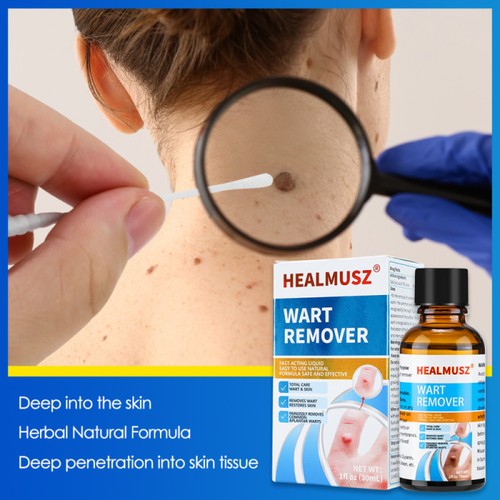 Healmusz rimuovi verruche - healmusz,