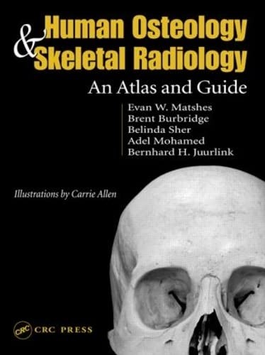 Human osteology and - human, skeletal