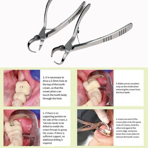 Pinza rimozione corona - , dentale