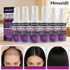 Minoxidil 2% per donna