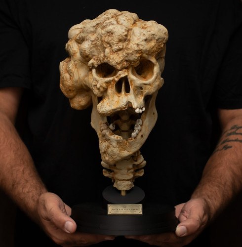 Joseph merrick skull - skull, replica