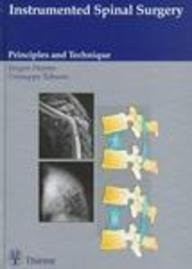 Instrumented spinal surgery - instrumented,