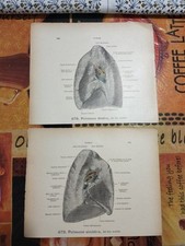 Lotto 2 Stampe Anatomiche Mediche Polmoni Werner Spalterholtz Vintage 