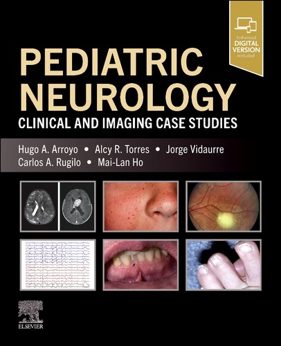 Pediatric neurology - pediatric,