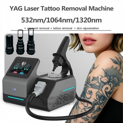 Macchina rimozione tatuaggi