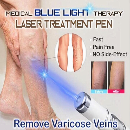Lcd laser plasma penna - lcd,