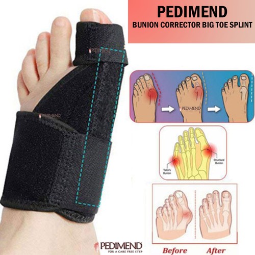 Pedimend ortopedico alluce - pedimend,