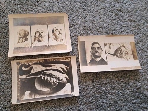 Tre antiche fotografie mediche