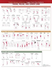 Travell, Simons & Simons Trigger Point Pain Patterns Wall Chart - 9781975183851