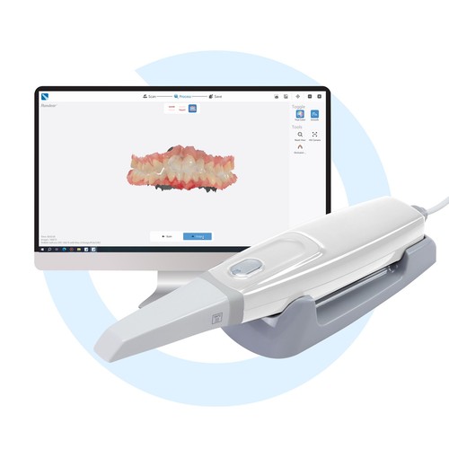 Dentista intra oral - scanner, 3d