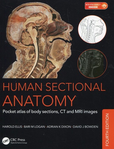 Human sectional anatomy - human,