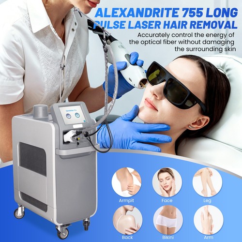 Macchina depilazione laser
